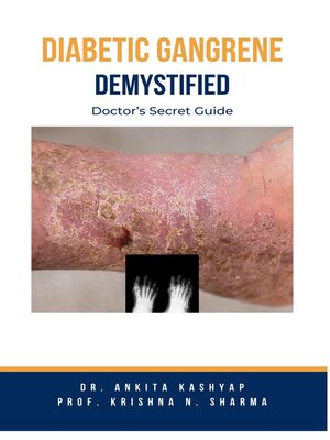 cover image of Diabetic Gangrene Demystified